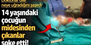 “14 Yaşındaki Kızda 3.5 Kilo Kıl Yumağı Bulundu”