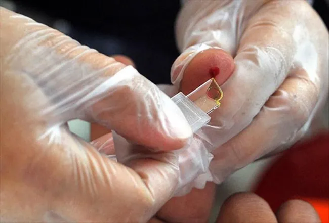 1728933543 983 Kan Gruplari ve Felc Riski A Grubu Daha Tehlikeli.webp Görsel 5