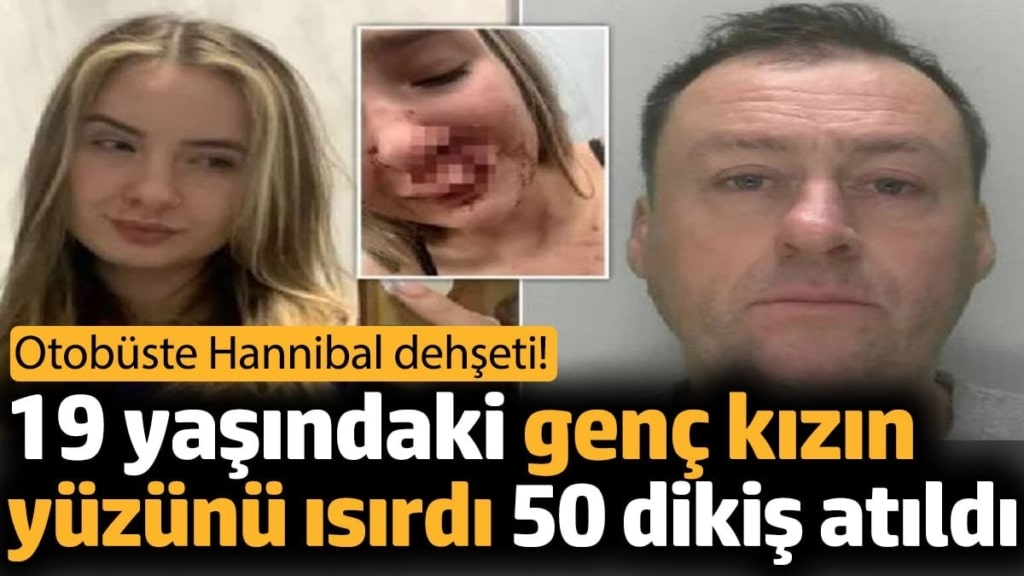 19 yaşındaki genç kızın yüzünü ısırdı 50 dikiş atıldı. Otobüste Hannibal dehşeti!