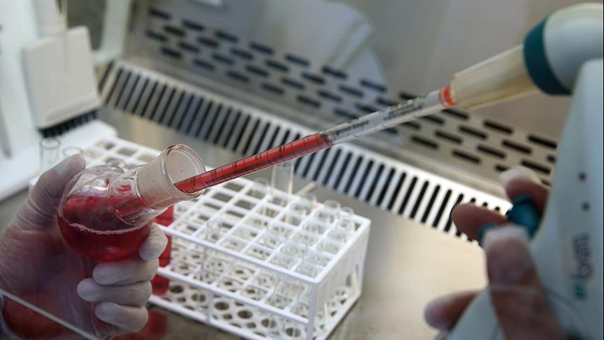 1729521203 725 A Kan Grubu Felc Riskini Artiriyor Felç riski