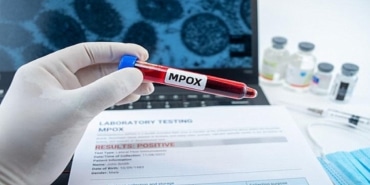 Mpox Aşısının Etkisi Zamanla Düşüyor!