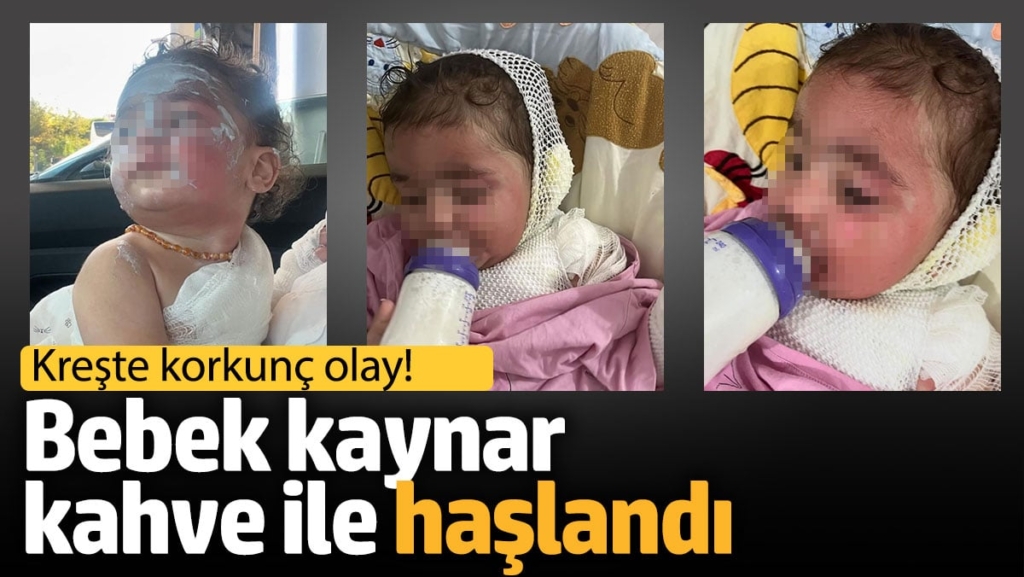Bebek kaynar kahve ile haşlandı. Kreşte korkunç olay!