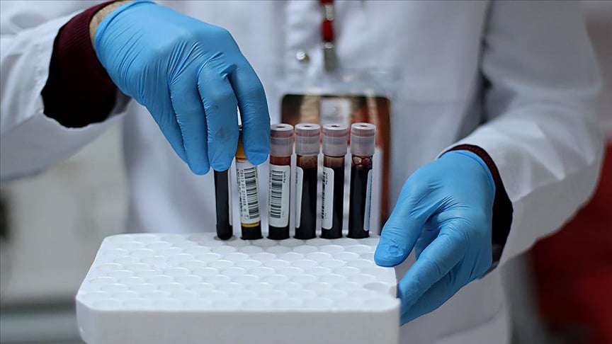 A Kan Grubu Felc Riskini Artiriyor Felç riski