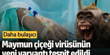 Almanya'da Yeni Maymun Çiçeği Varyantı Tespit edildi