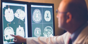 Alzheimer Tedavisinde Yeni Umut: Hedefli Proteinler!