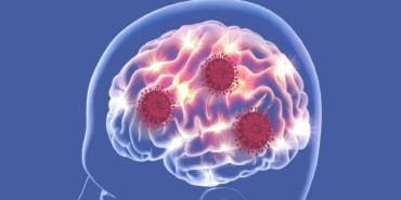 Hafif COVID-19 Gençlerin Beyin Sağlığını Tehdit Ediyor