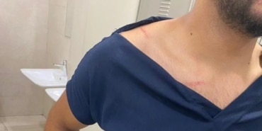 Hasta yakınları hemşireyi darp etti