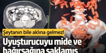 Şeytanın bile aklına gelmez! Uyuşturucuyu mide ve bağırsağına saklamış