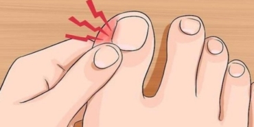 Tırnak Batmasını Önlemek İçin 5 Pratik İpucu