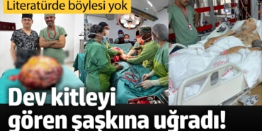 Trabzon'da 26 Kiloluk Dev Tümör Ameliyatı!