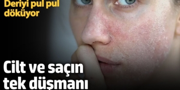 Stresin Derideki Yaşlanma Etkileri Açıklandı!