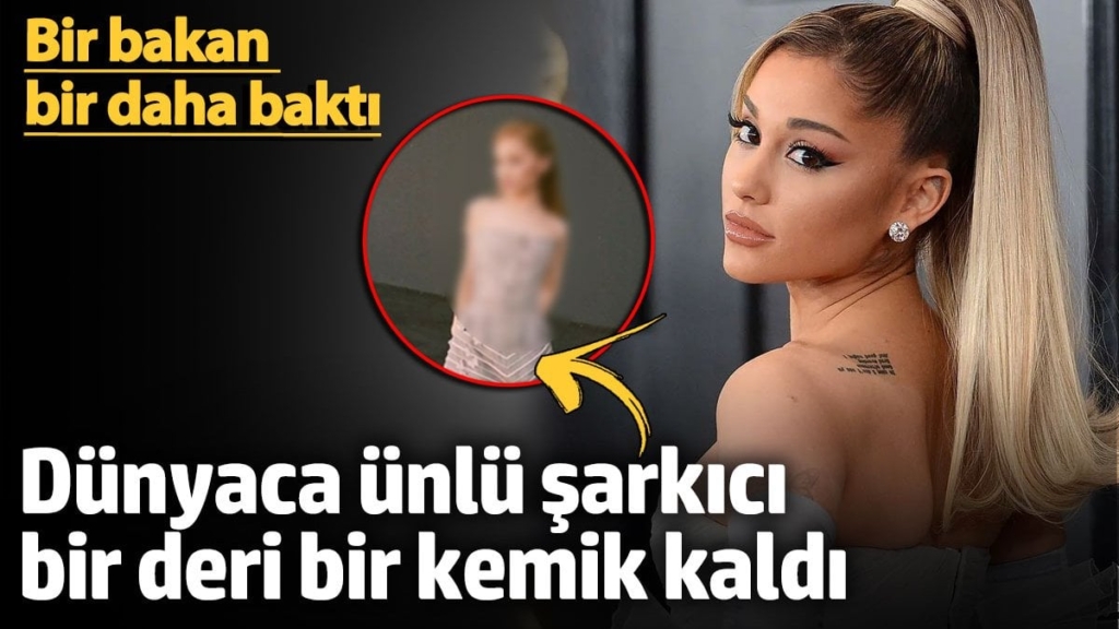 Dünyaca ünlü şarkıcı bir deri bir kemik kaldı! Bir bakan bir daha baktı