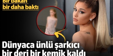 Dünyaca ünlü şarkıcı bir deri bir kemik kaldı! Bir bakan bir daha baktı