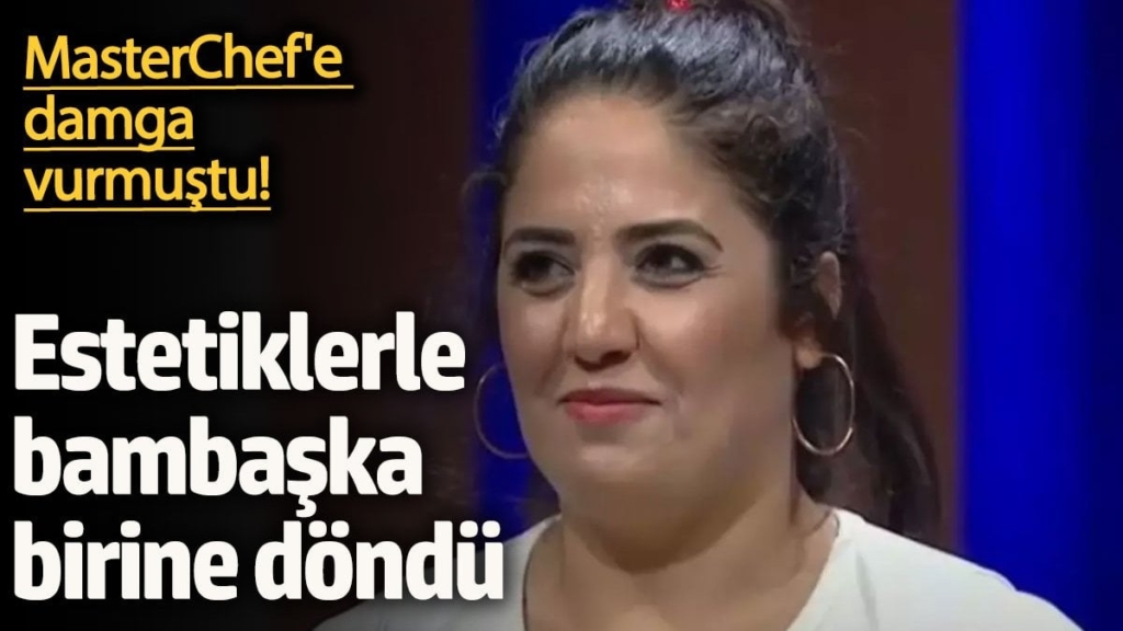MasterChef'e damga vurmuştu! Estetiklerle bambaşka birine döndü