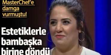 MasterChef'e damga vurmuştu! Estetiklerle bambaşka birine döndü