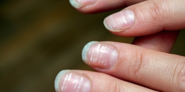 Demir Eksikliği: Ciddi Sağlık Risklerine Dikkat!