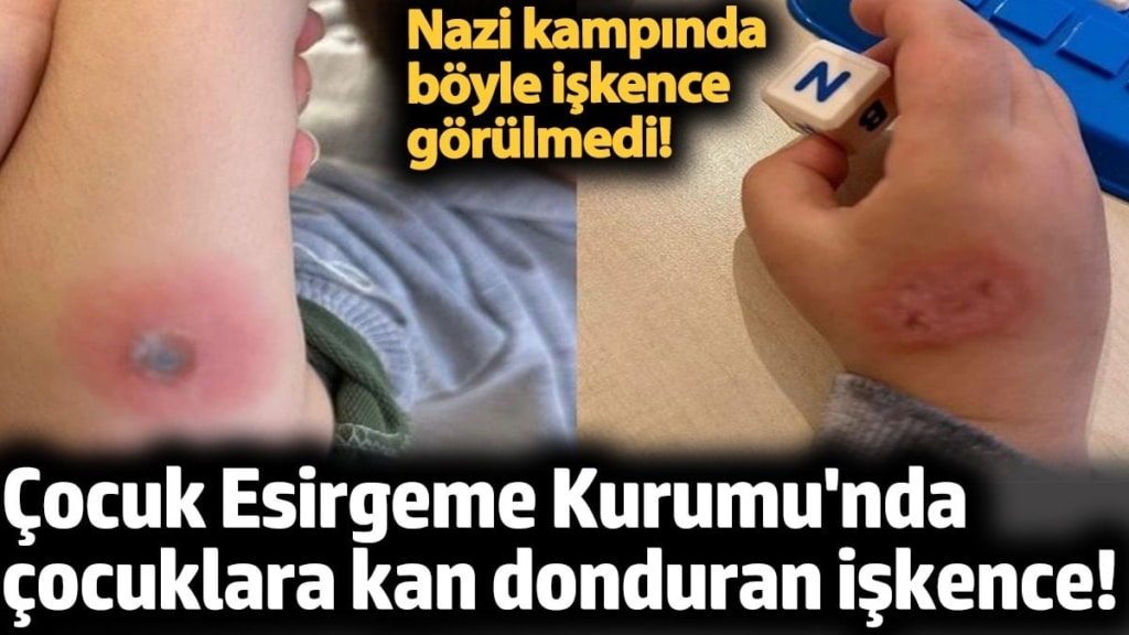 Çocuk Esirgeme Kurumu'nda çocuklara kan donduran işkence! Nazi kampında böyle işkence görülmedi