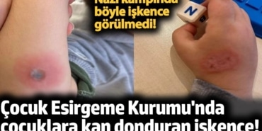 Çocuk Esirgeme Kurumu'nda çocuklara kan donduran işkence! Nazi kampında böyle işkence görülmedi