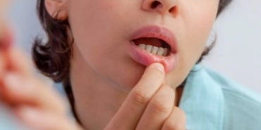 Geçmeyen Yaralar: Sağlığınızı Tehdit Ediyor!