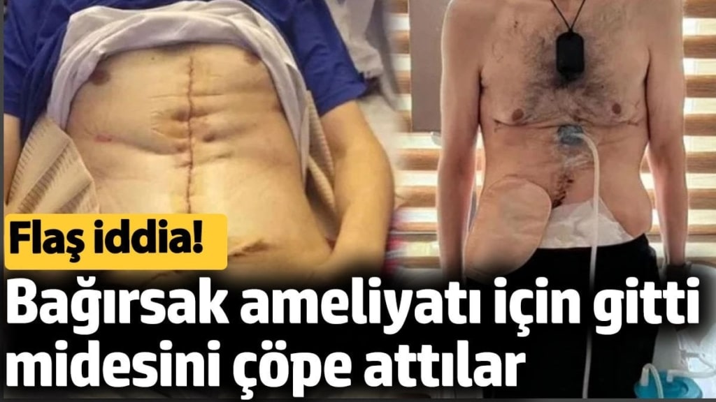 Bağırsak ameliyatı için gitti midesini çöpe attılar. Flaş iddia