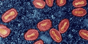 Londra'da Mpox'un Tehlikeli Yeni Varyantı Bulundu