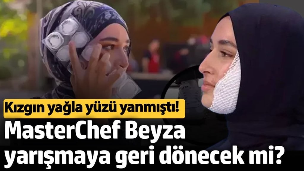 Kızgın yağla yüzü yanmıştı!  MasterChef Beyza yarışmaya geri dönecek mi?