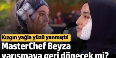 Kızgın yağla yüzü yanmıştı!  MasterChef Beyza yarışmaya geri dönecek mi?