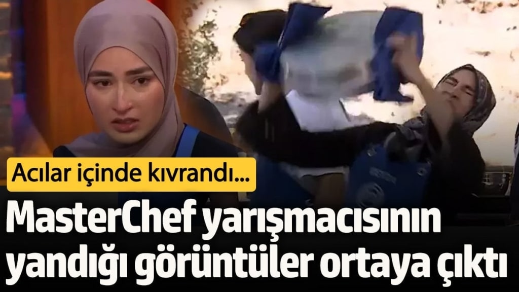 MasterChef Beyza’nın yandığı görüntüler ortaya çıktı! Acılar içinde kıvrandı…
