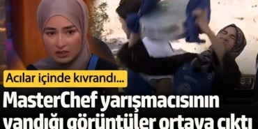 MasterChef Beyza’nın yandığı görüntüler ortaya çıktı! Acılar içinde kıvrandı…