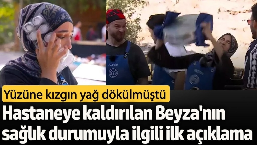 Yüzüne kızgın yağ döküldü...  MasterChef Beyza apar topar hastaneye kaldırıldı!  İlk açıklama geldi