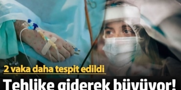 Maymun Çiçeği Varyantı Küresel Acil Durum İlan Edildi