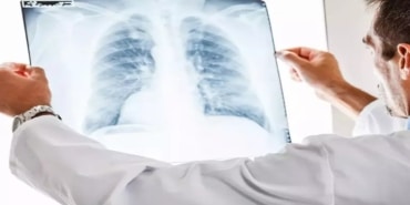 Ölümcül Zatürre: Yeni Tedavi Yöntemleri Gelişiyor!