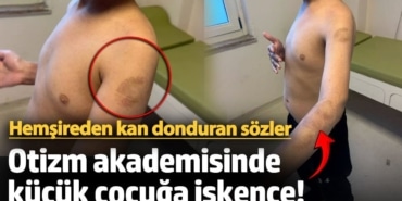 Özel Akademide Çocuğa Darp İddiası Şok Etmiş!