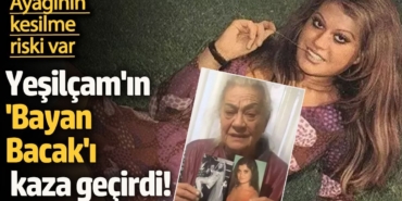 Yeşilçam'ın 'Bayan Bacak'ı kaza geçirdi!  Ayağının kesilme riski var