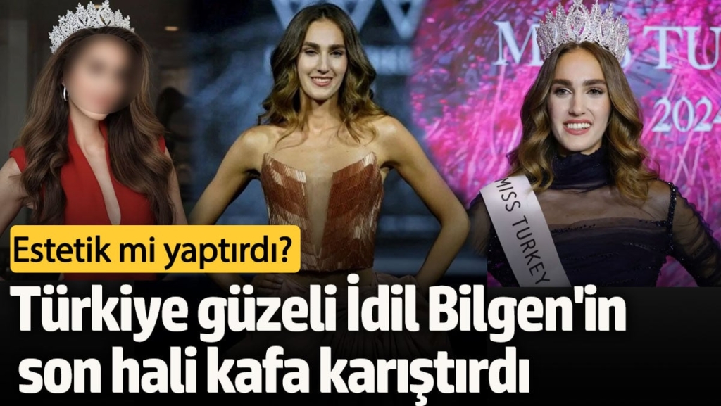 Estetik mi yaptırdı?  Türkiye güzeli İdil Bilgen'in son hali kafa karıştırdı!