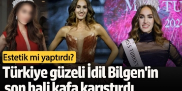 Estetik mi yaptırdı?  Türkiye güzeli İdil Bilgen'in son hali kafa karıştırdı!