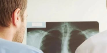 Zatürre Riski Artıyor: Çocuklar ve Yaşlılar Dikkat!