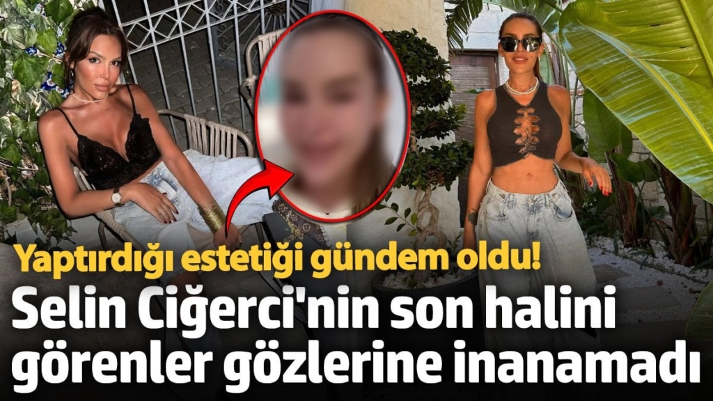 Selin Ciğerci'nin son halini görenler gözlerine inanamadı! Yüzüne yaptırdığı estetik gündem oldu!