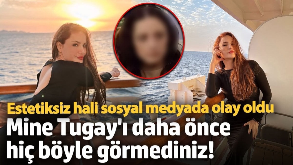 Mine Tugay'ı daha önce hiç böyle görmediniz! Estetiksiz hali sosyal medyada olay oldu