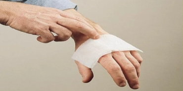 Yanık Tedavisi Hataları: Uyarılar